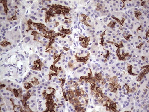 KRT19 / CK19 / Cytokeratin 19 Antibody (aa240-390, clone OTI5B11)
