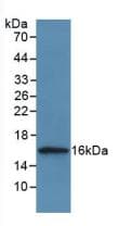 CSTA / Cystatin A Antibody (aa1-98)