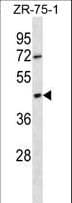 OR2T6 Antibody (aa244-272)