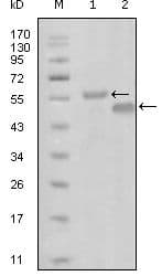 EPHA6 / EPH Receptor A6 Antibody (Amino Acid: 695-795, clone 3D5B10)