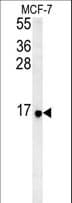 S26 / RPS26 Antibody (aa1-30)