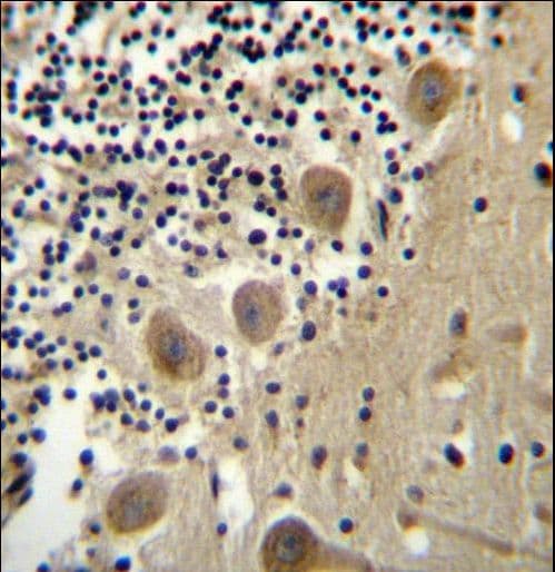 BEND6 Antibody (aa226-254)