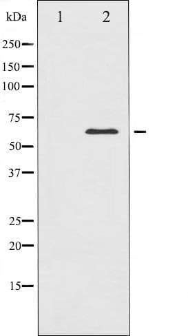CAMK4 / CaMK IV Antibody
