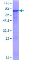 Human PLEKHM2 / SKIP Protein (Recombinant GST)