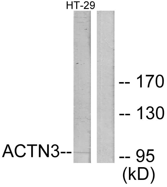 IHC-plus™ ACTN3 Antibody (aa1-50)