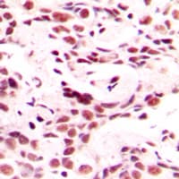 HOXB9 Antibody (C-Terminus)