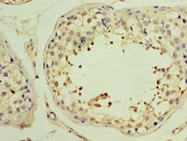 YARS2 Antibody (aa228-477)