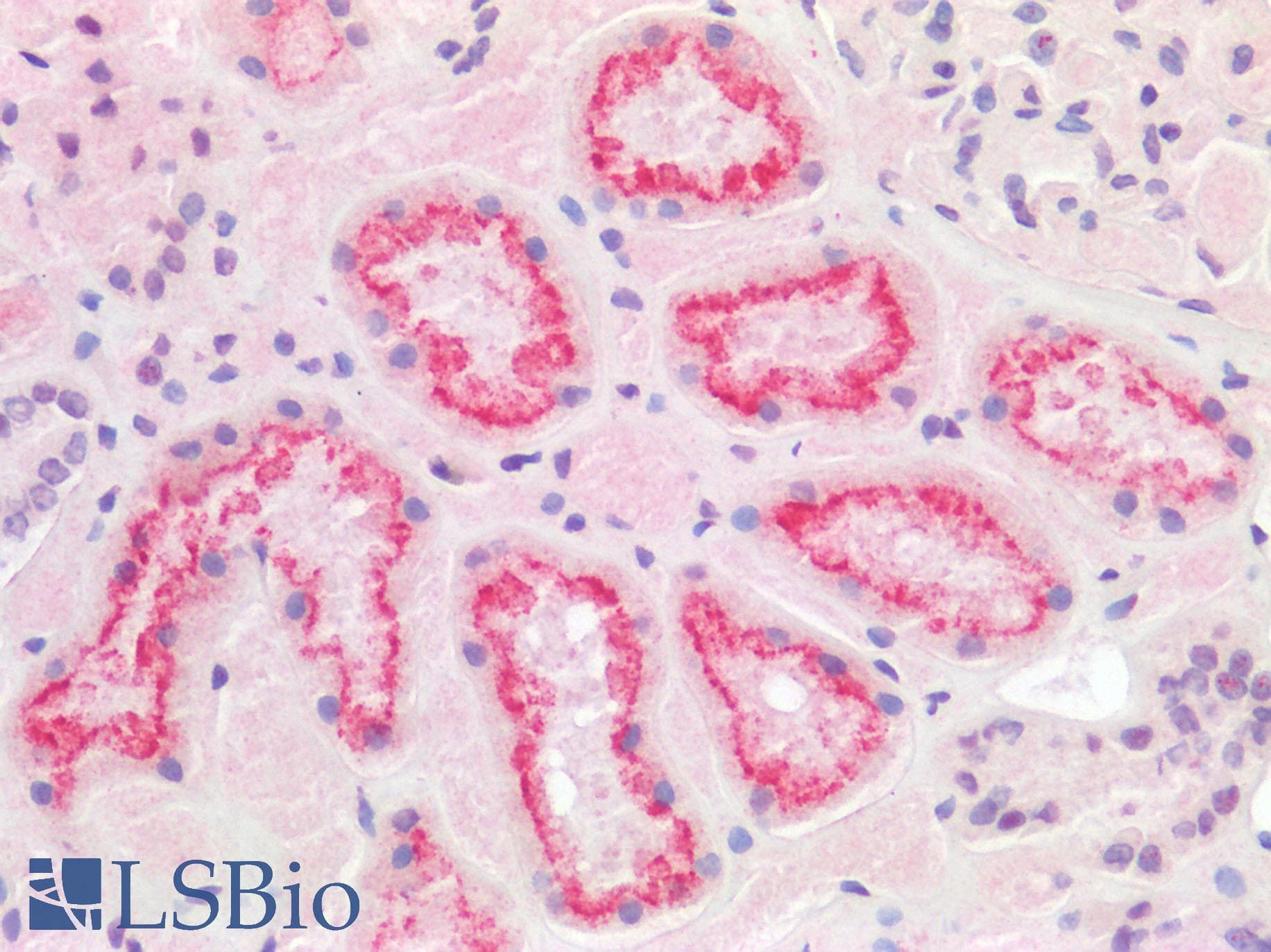 IHC-plus™ Polyclonal Rabbit anti-Human TMPRSS2 / Epitheliasin Antibody (IHC)
