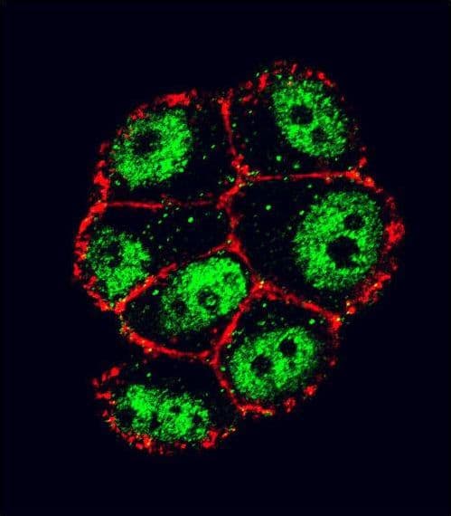 Polyclonal Rabbit anti-Human NFKBIA / IKB Alpha / IKBA Antibody (aa12-41, IHC, IF, WB)
