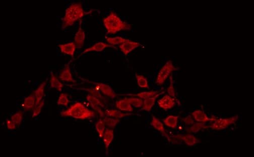 Polyclonal Rabbit anti-Human EIF4E Antibody (IHC, IF, WB)