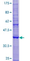 Human TMEM68 Protein (Recombinant GST)