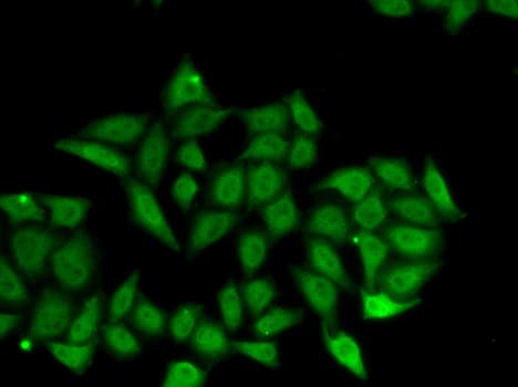 ICSBP / IRF8 Antibody