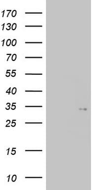 TGIF1 Antibody (clone OTI1A6, Carrier-free)