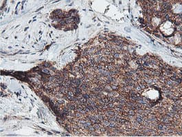 NPTN / SDR1 Antibody (clone OTI2D4)
