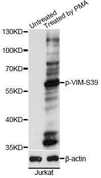 Polyclonal Rabbit anti-Human Vimentin Antibody (phospho-Ser39, WB)