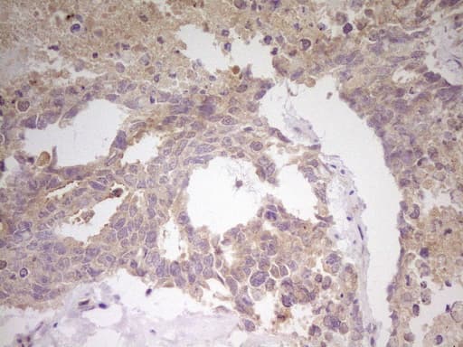 CITED1 Antibody (clone OTI3C12)