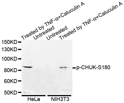 CHUK / IKKA / IKK Alpha Antibody (phospho-Ser180)