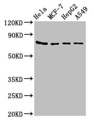 Polyclonal Rabbit anti-Human HSPA5 / GRP78 / BiP Antibody (IHC, WB)