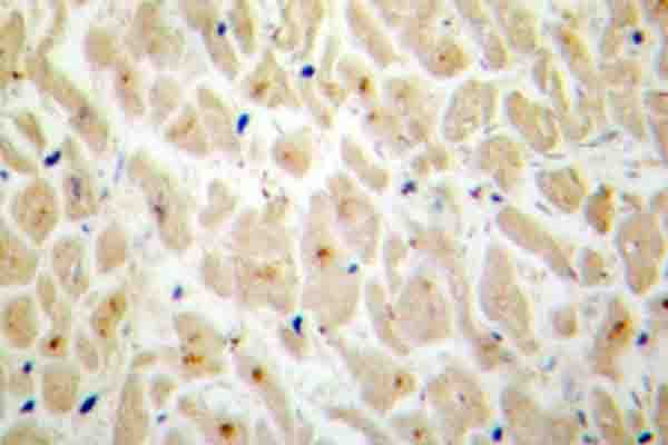 Polyclonal Rabbit anti-Human MAPKAPK2 / MAPKAP Kinase 2 Antibody (Asn218, IHC, WB)