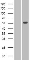 UGT1A3 Protein (Over-Expression Lysate Myc-DDK (Flag))
