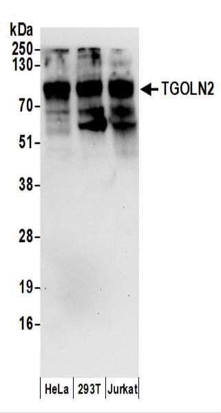 TGN46 / TGN38 Antibody (aa175-225)