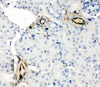 Polyclonal Rabbit anti-Human Adiponectin Antibody (aa224-244, IHC, WB)