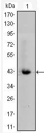 CTNNB1 / Beta Catenin Antibody (clone 4D5)