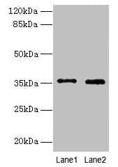 Polyclonal Rabbit anti-Human FOXR2 Antibody (IHC, WB)