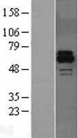 ACTRIIB / ACVR2B Protein (Over-Expression Lysate Myc-DDK (Flag))