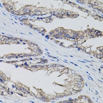 CD95 / FAS Antibody