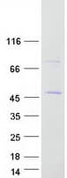 Human ZNF435 / ZSCAN16 Protein (Recombinant Myc-DDK (Flag))