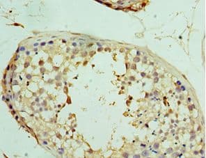 USP8 / UBPY Antibody (aa1-270)