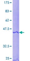 Human ARF5 Protein (Recombinant GST)
