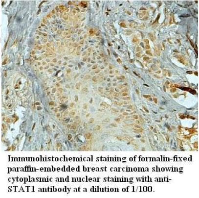 STAT1 Antibody (aa519-712)