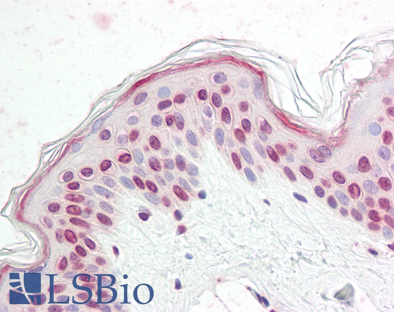 IHC-plus™ NKX2-4 Antibody