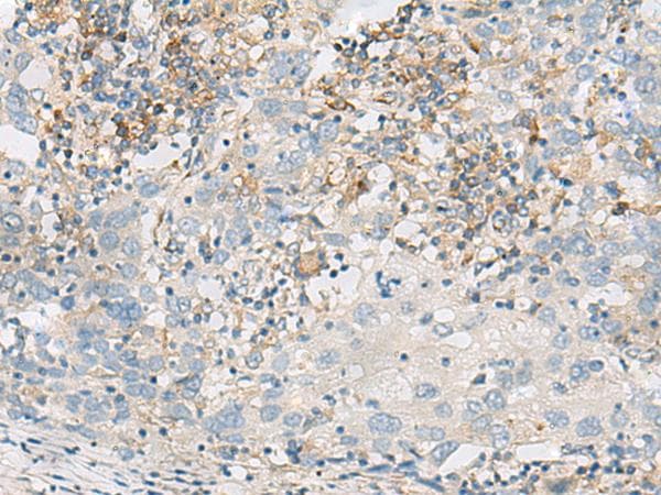 NATO3 / FERD3L Antibody