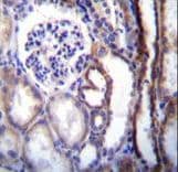 Polyclonal Rabbit anti-Human ATP6V1B1 Antibody (aa284-310, IHC, IF, WB)