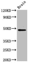 Polyclonal Rabbit anti-Human RAD9B Antibody (WB)
