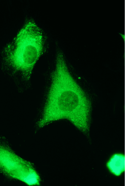 Polyclonal Rabbit anti-Human YWHAZ / 14-3-3 Zeta Antibody (IHC, WB)