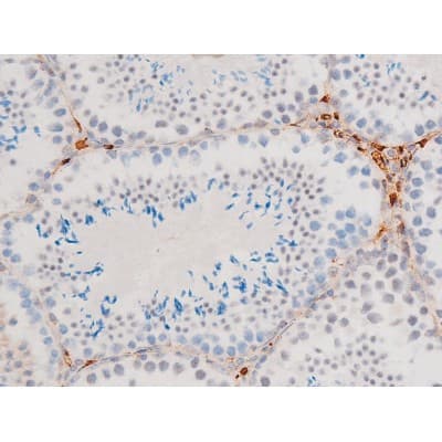 GATA4 Antibody (phospho-Ser105)