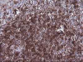 CD1C Antibody (clone OTI2B3)