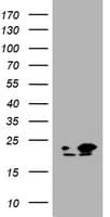 NME1 / NM23 Antibody (clone OTI7A1)