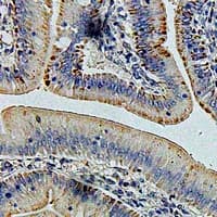 Polyclonal Rabbit anti-Human GLUD1/Glutamate Dehydrogenase Antibody (IHC, WB)