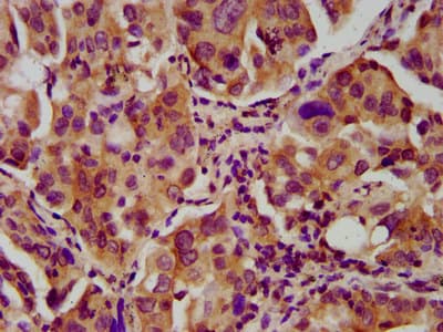 NEB / Nebulin Antibody