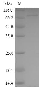 Human KEAP1 Protein (Recombinant 6His, N-terminus)