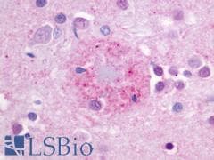PathPlus™ Polyclonal Rabbit anti-Human GPR176 Antibody (C-Terminus, IHC)