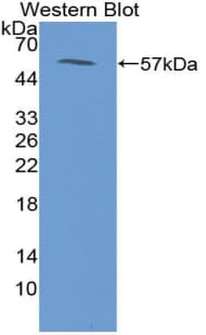 CIDEA / CIDE-A Antibody (aa1-219, Biotin)
