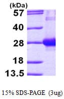 Human RAB7A / RAB7 Protein (Recombinant His)