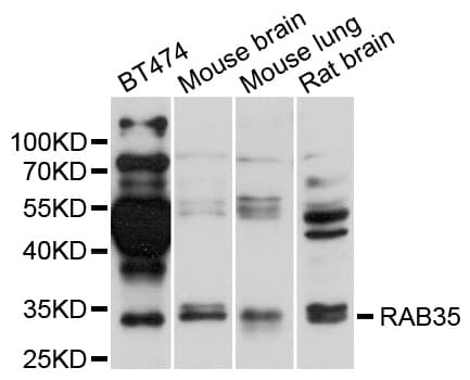 RAB35 Antibody