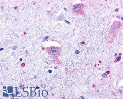PathPlus™ PAEL Receptor / GPR37 Antibody (N-Terminus)